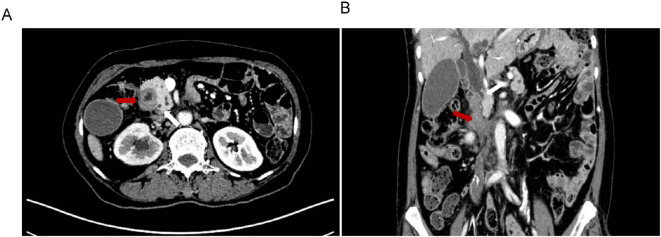 Figure 1