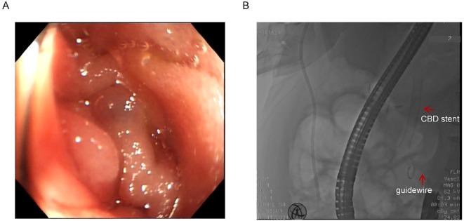 Figure 2