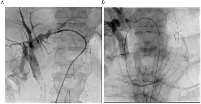 Figure 3