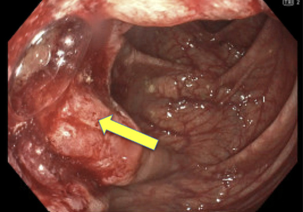 Figure 1