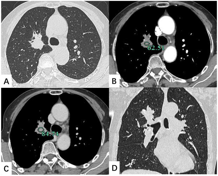 Figure 1