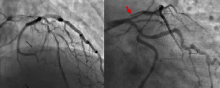 FIGURE 2