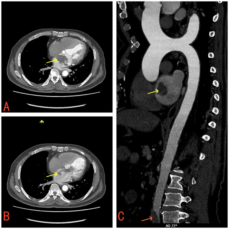 Figure 1