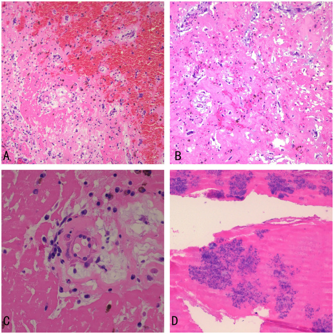 Figure 4