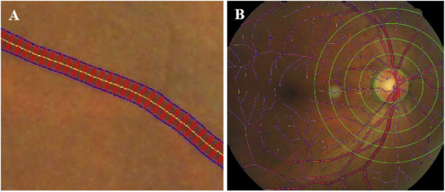 FIGURE 3
