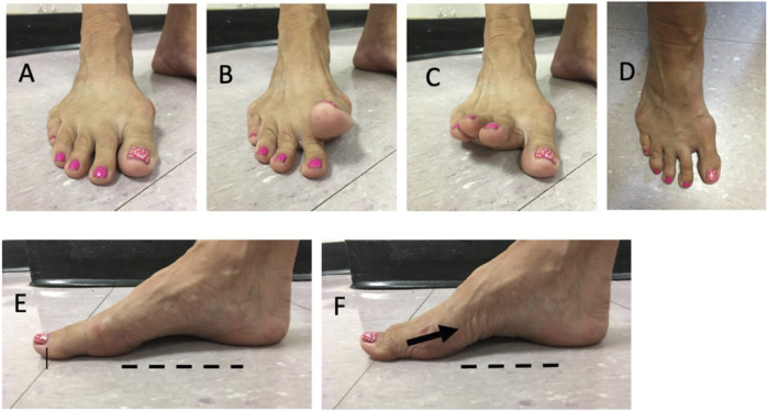FIGURE 1