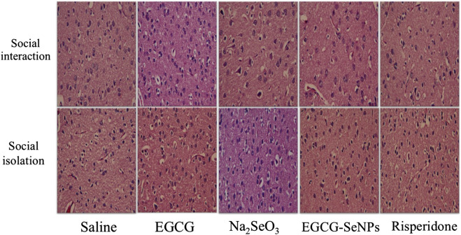 FIGURE 11