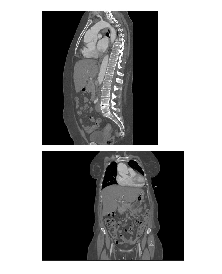 Figure-5