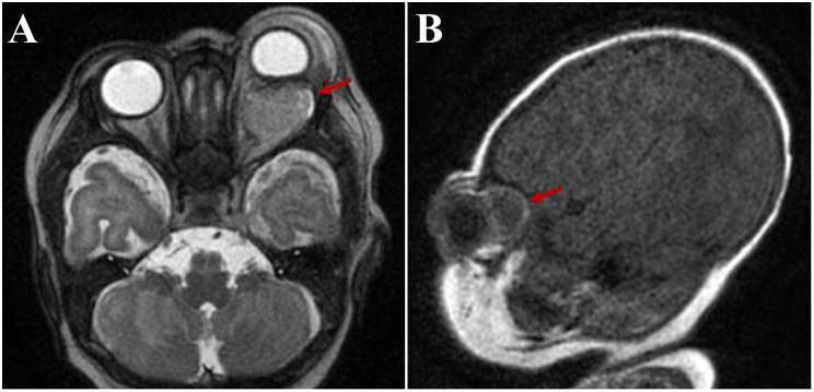 Figure 2