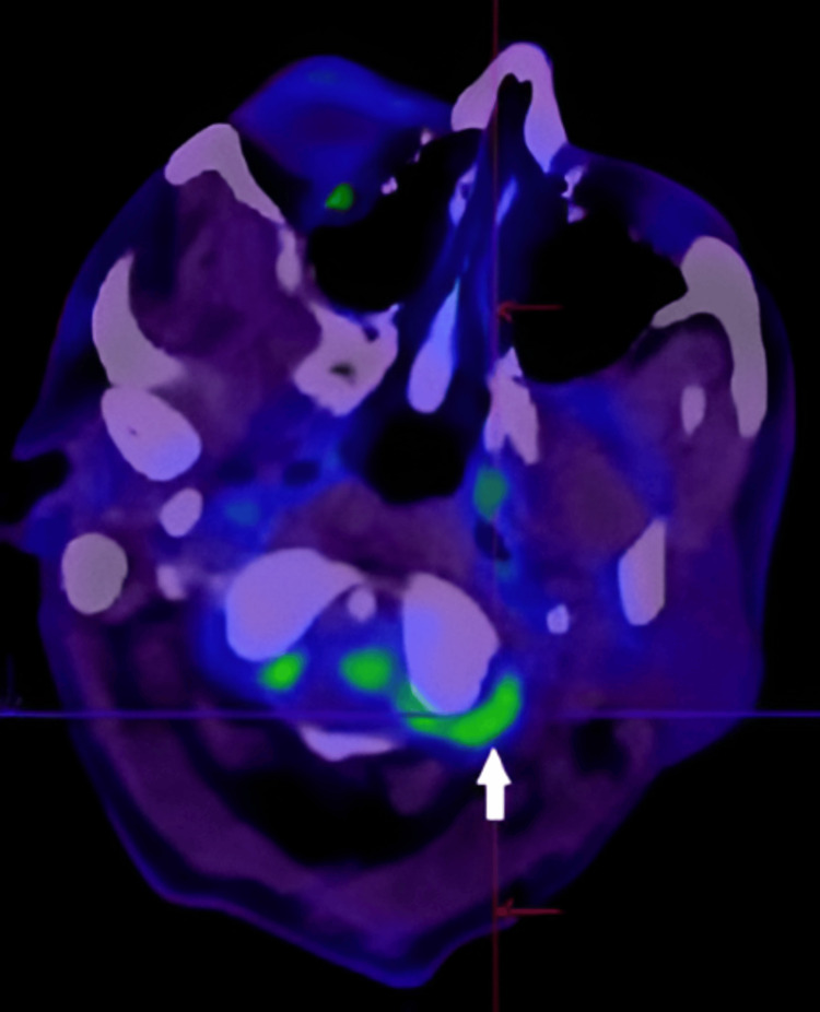 Figure 6