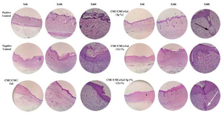 Figure 13