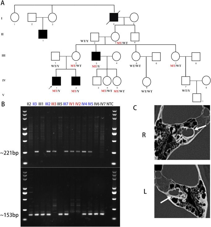 FIGURE 1