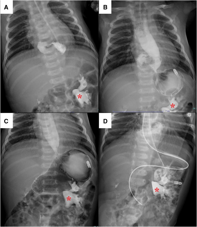 Fig. 3