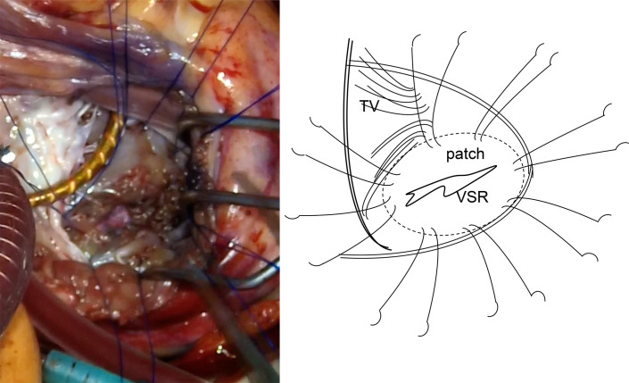 Fig. 4