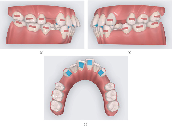 Figure 6