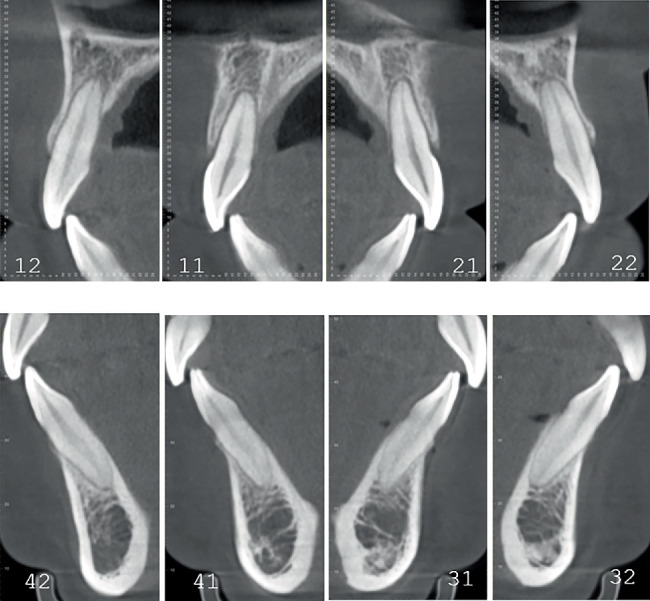 Figure 12