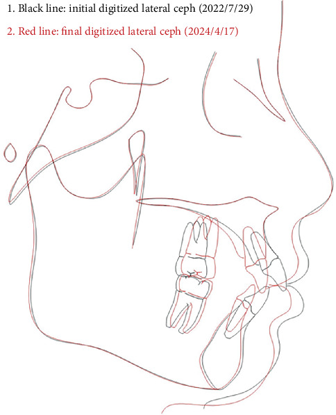 Figure 14