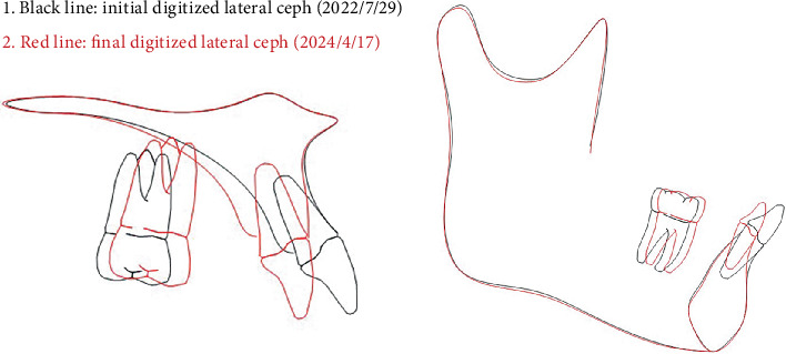 Figure 15