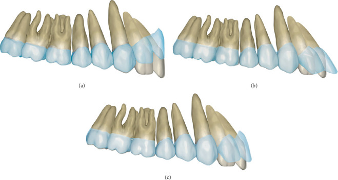 Figure 16