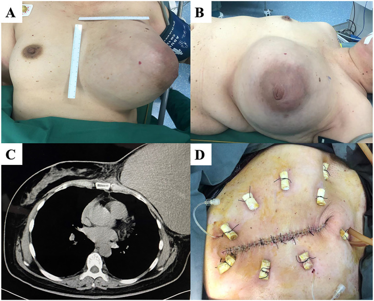 Figure 3