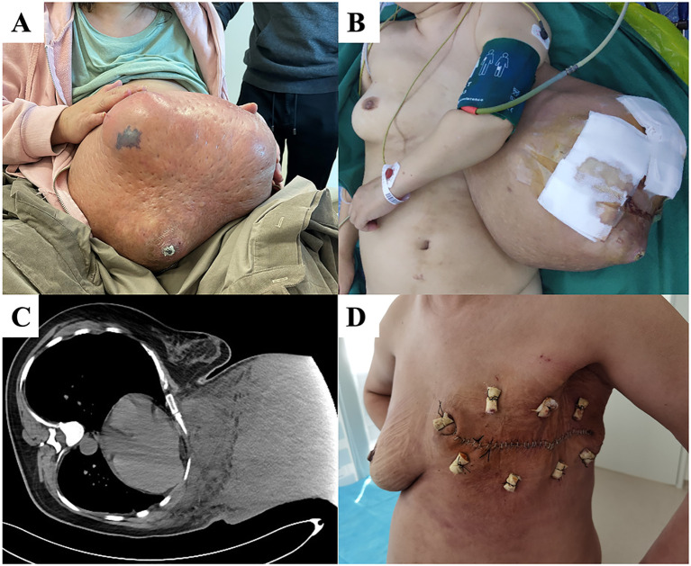 Figure 4