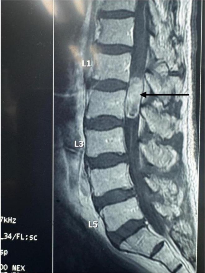 FIGURE 2