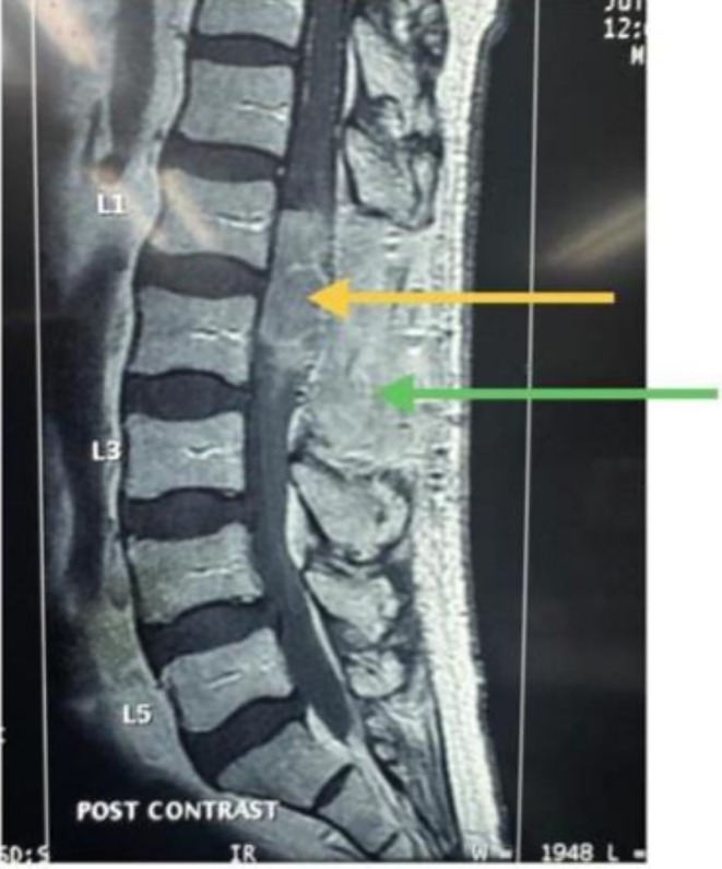 FIGURE 4