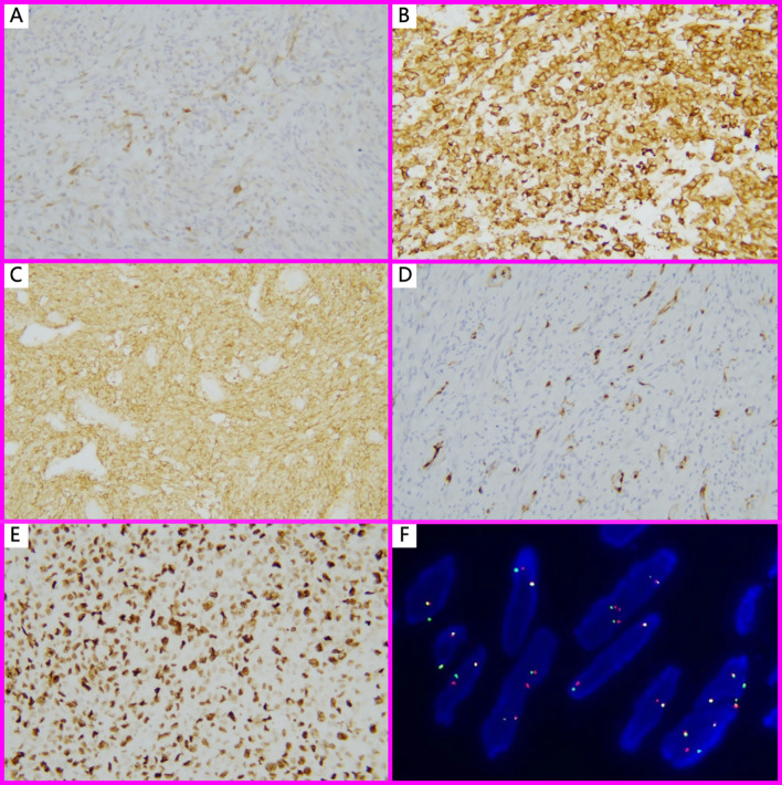 Figure 2