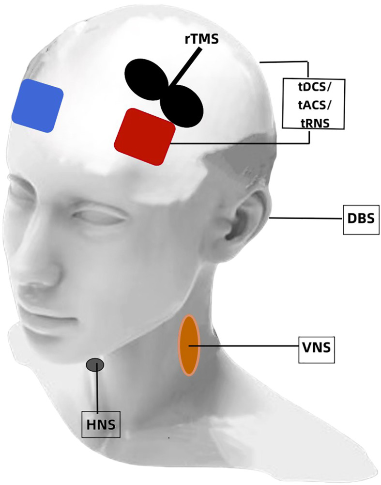 Figure 1