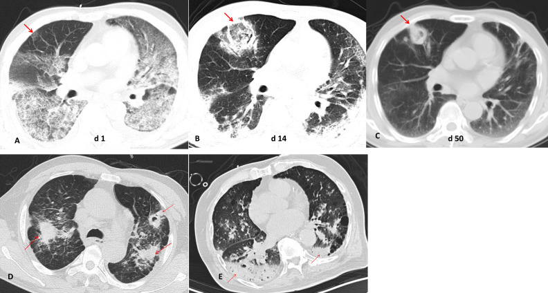Figure 2