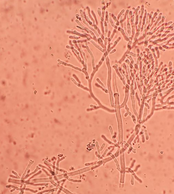 Figure 3