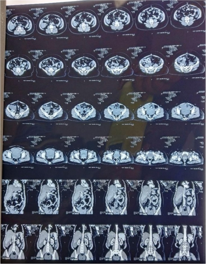FIGURE 6