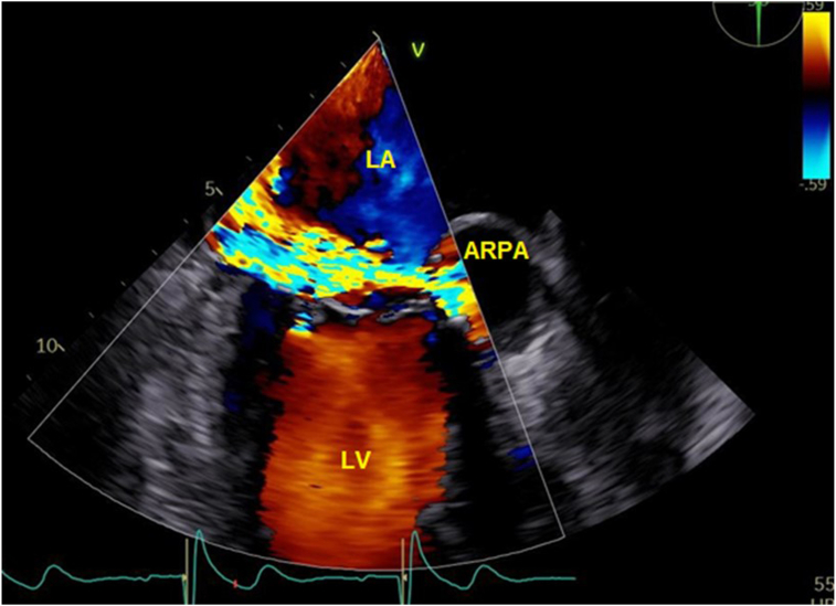 Figure 4