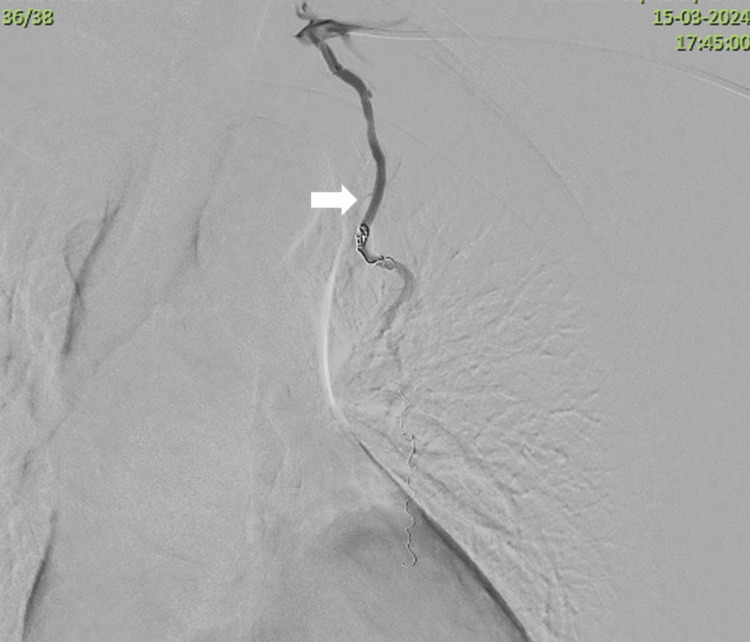 Figure 9