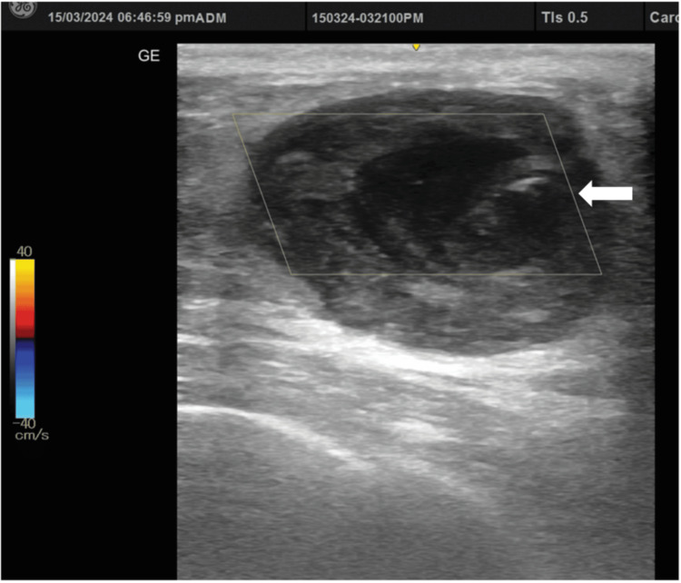 Figure 10