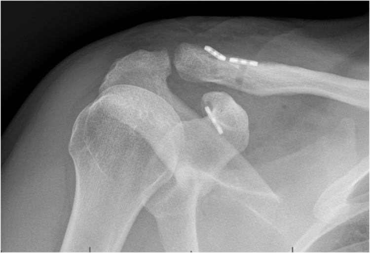 Figure 10