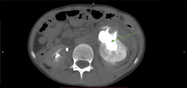 Figure 9