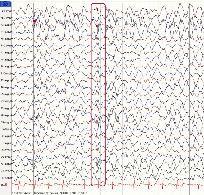 Figure 10