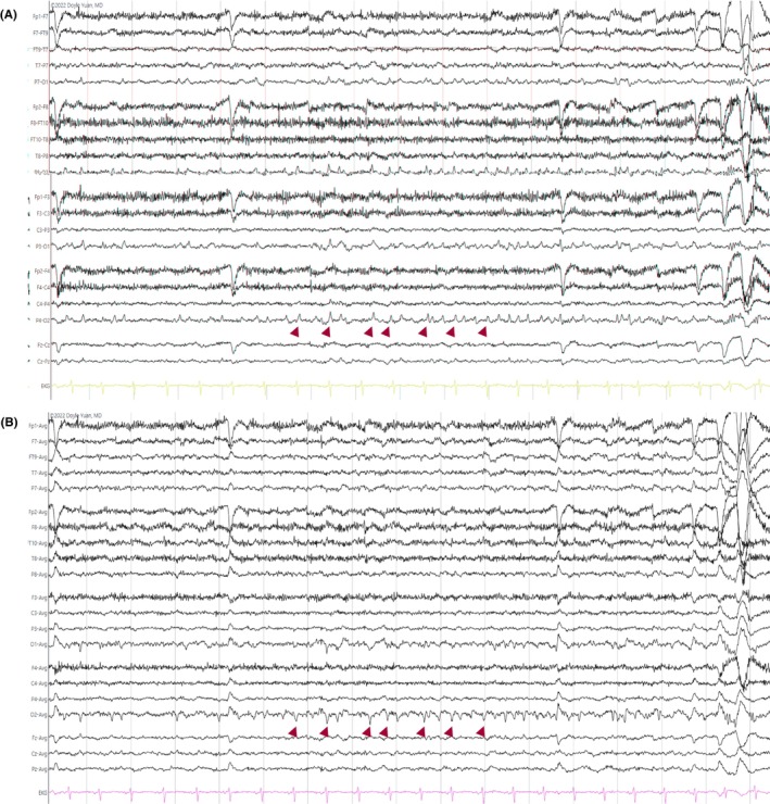 Figure 11