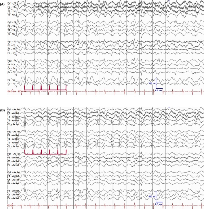 Figure 12