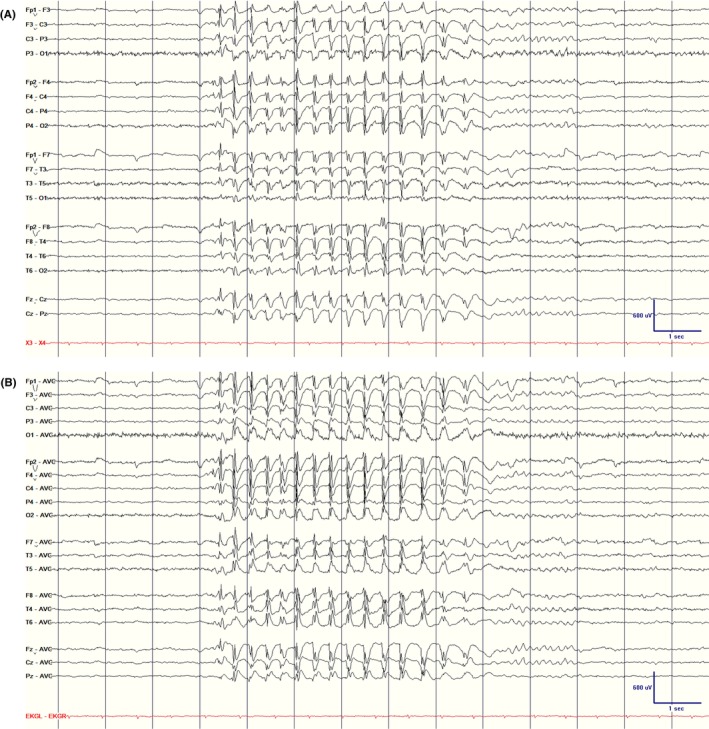 Figure 13