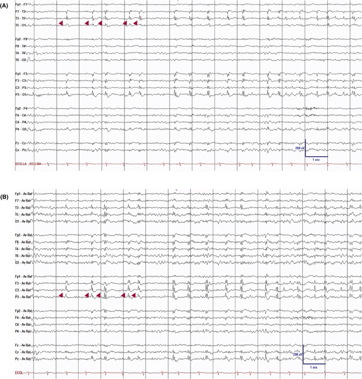 Figure 14