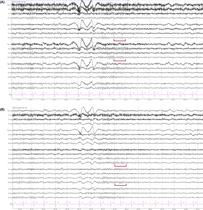 Figure 15