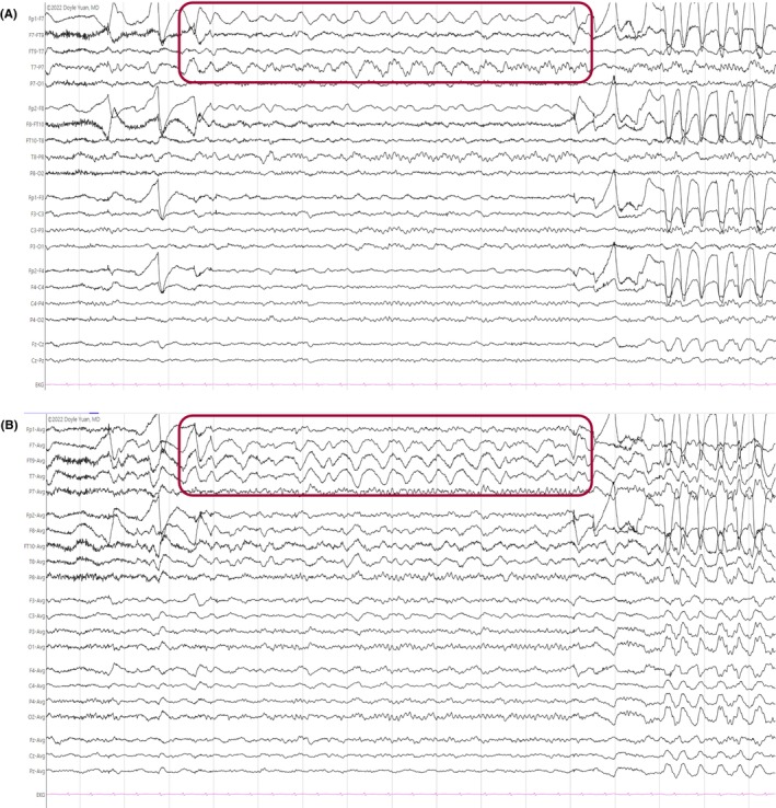 Figure 16