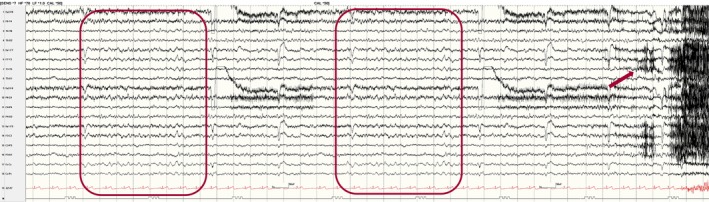 Figure 17