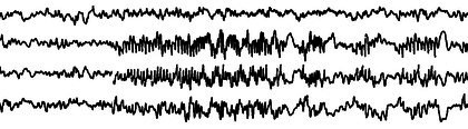 Figure 21