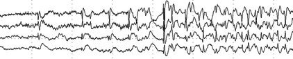 Figure 22