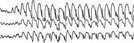 Figure 23