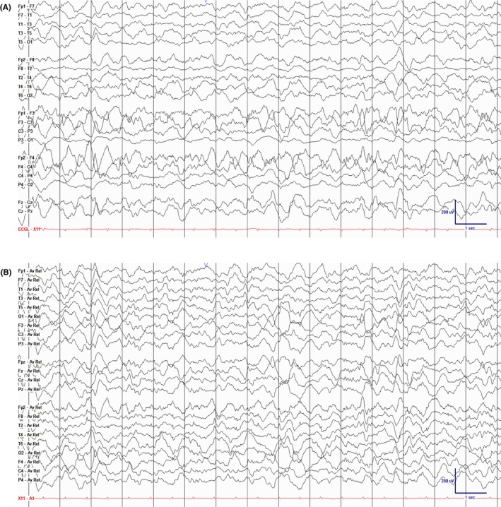 Figure 24