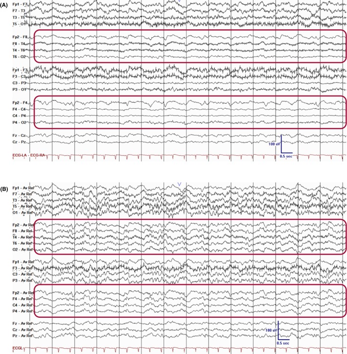 Figure 25